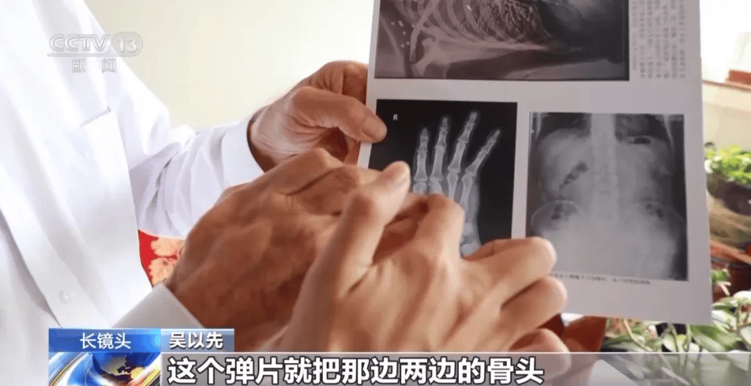 “老先生，您把项链取下来再做CT”